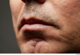  HD Face Skin Benito Romero face lips mouth scar skin pores skin texture 0003.jpg